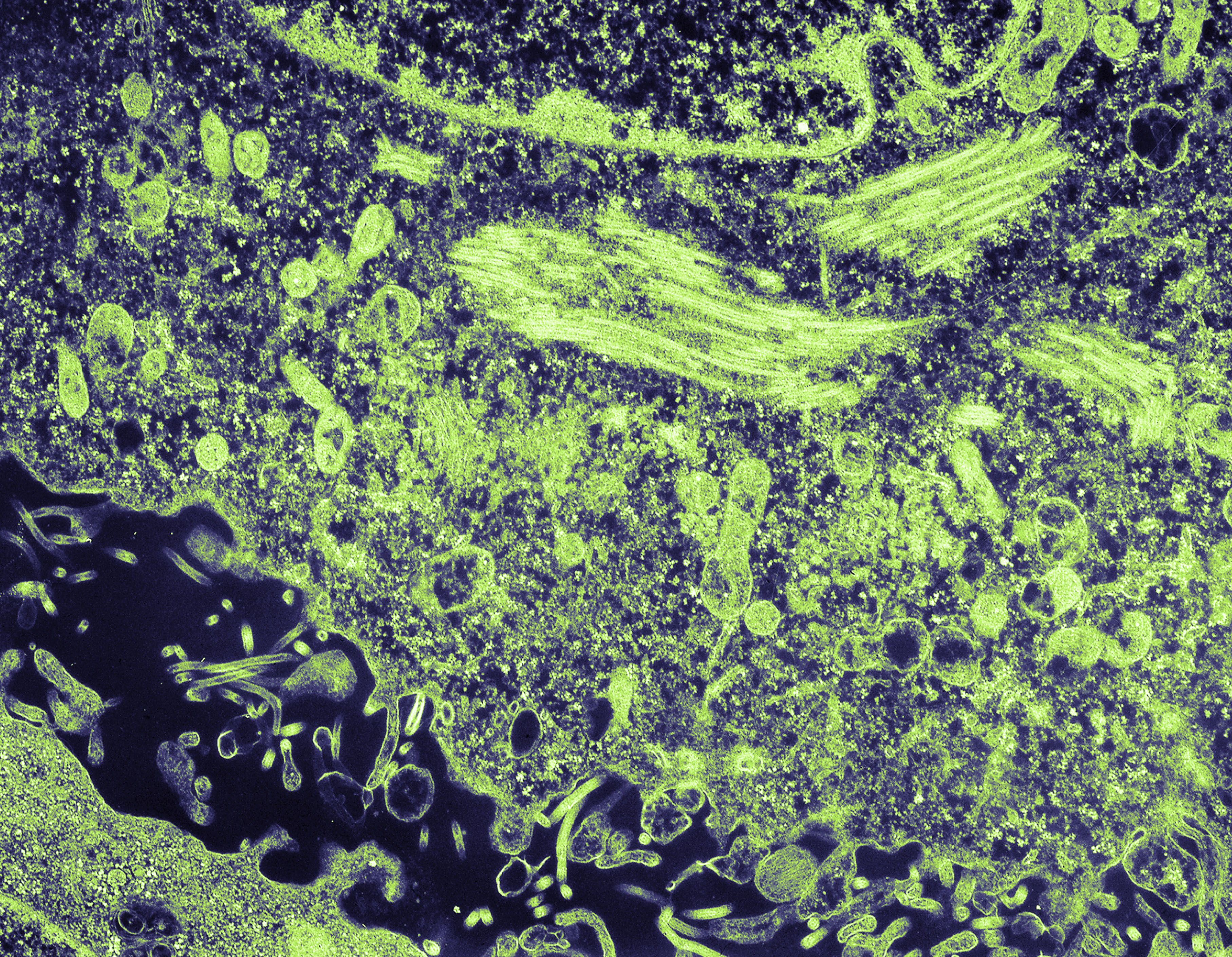 Ebola electron micrograph 1976